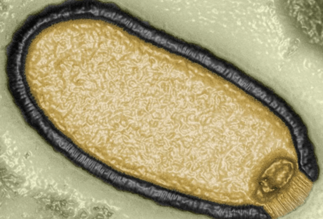 Microfotografía de Pithovirus sibericum que se aisló de una muestra de permafrost de 30.000 años de antigüedad en 2014 - (Cortesía CNN)