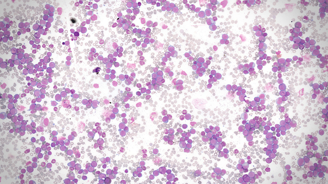 Miembros del grupo de investigación del Centro de Investigación del Cáncer (USAL-CIC-IBMCC) Salamanca (imagen USAL)
